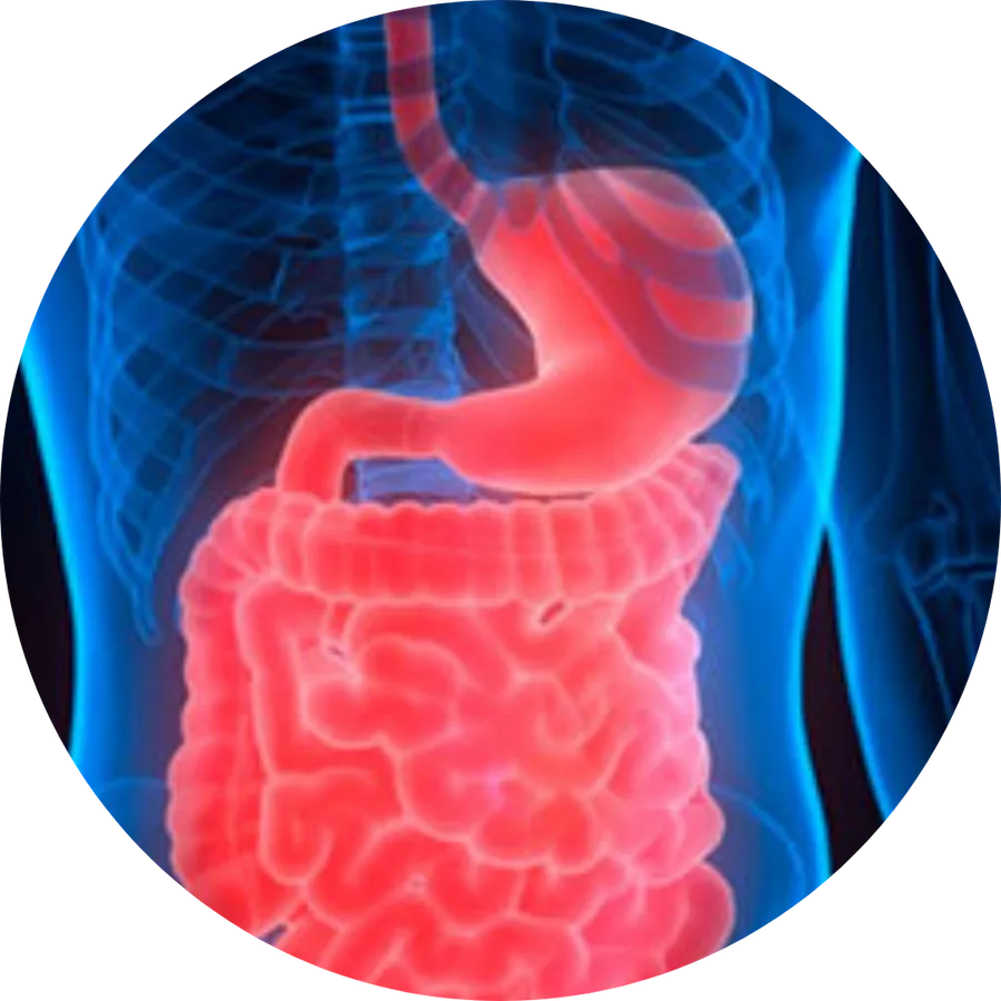 Cirugía bariátrica